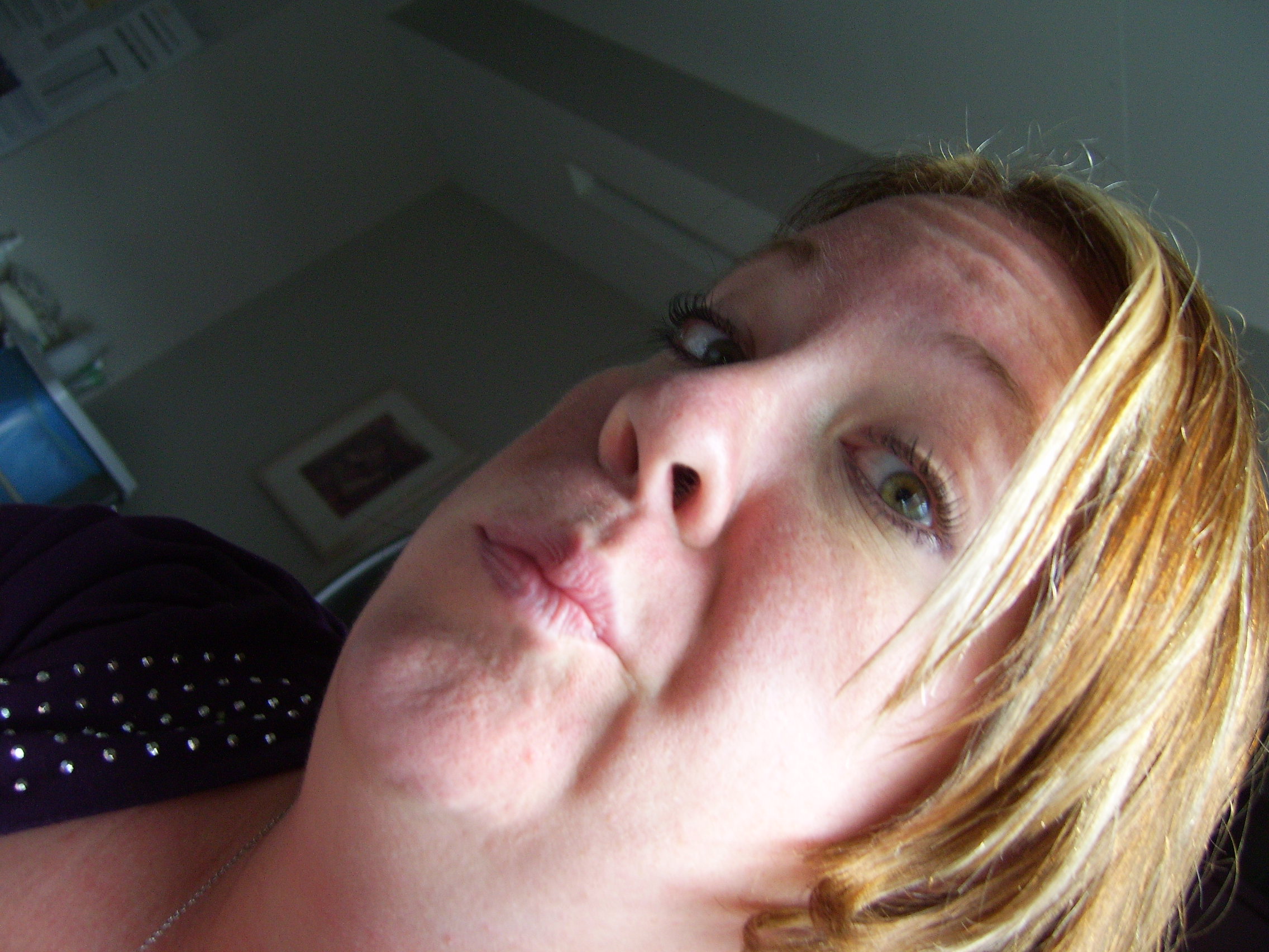 Me making a goofy face while being bored (Kevin is still a bit sedated from the JG feeding tube procedure)